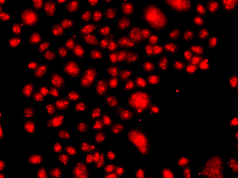 Immunofluorescence - FANCM Polyclonal Antibody 