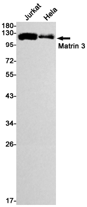 Western blot detection of Matrin 3 in Jurkat,Hela cell lysates using Matrin 3 Rabbit mAb(1:1000 diluted).Predicted band size:95kDa.Observed band size:125kDa.
