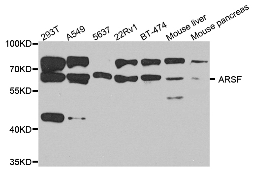 Western blot - ARSF Polyclonal Antibody 