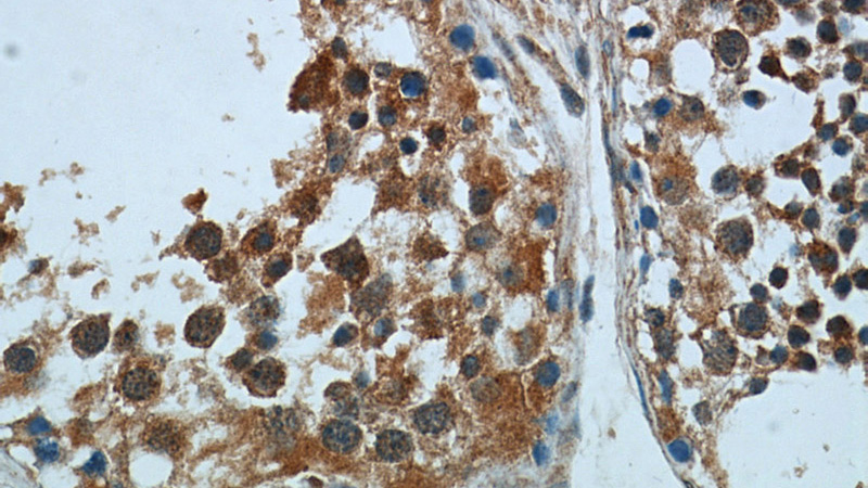 Immunohistochemical of paraffin-embedded human testis using Catalog No:114089(PPP1R2P9 antibody) at dilution of 1:50 (under 40x lens)