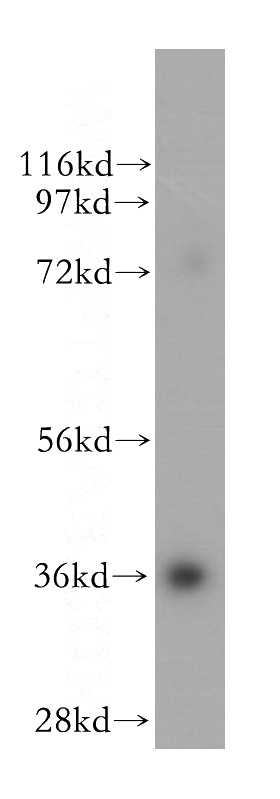 human brain tissue were subjected to SDS PAGE followed by western blot with Catalog No:115161(SFXN3 antibody) at dilution of 1:500