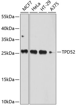 Western blot - TPD52 Polyclonal Antibody 