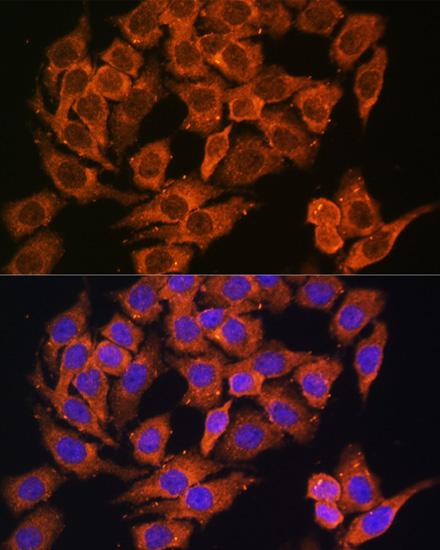 Immunofluorescence - MYO6 Polyclonal Antibody 