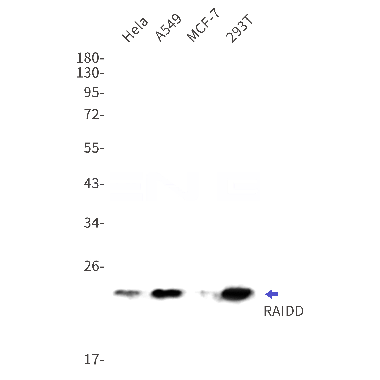 Western blot detection of RAIDD in Hela,A549,MCF-7,293T cell lysates using RAIDD Rabbit mAb(1:1000 diluted).Predicted band size:23kDa.Observed band size:23kDa.