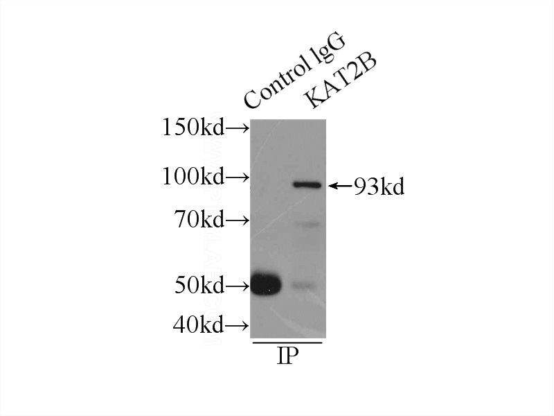 IP Result of anti-KAT2B (IP:Catalog No:113620, 4ug; Detection:Catalog No:113620 1:300) with HeLa cells lysate 2000ug.