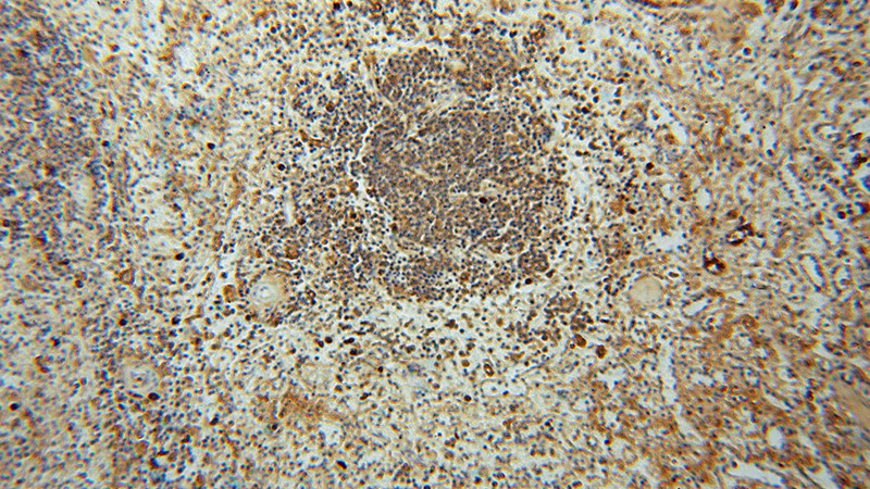 Immunohistochemical of paraffin-embedded human spleen using Catalog No:111691(IGK- antibody) at dilution of 1:100 (under 10x lens)