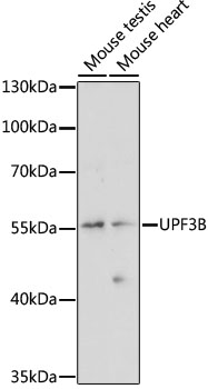 Western blot - UPF3B Polyclonal Antibody 