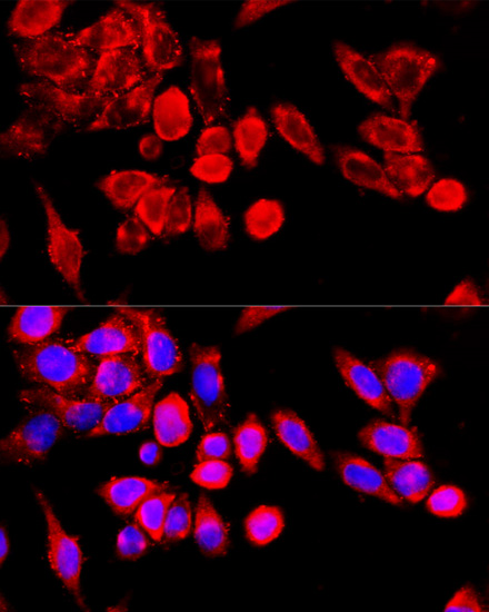 Immunofluorescence - TRPC6 Polyclonal Antibody 