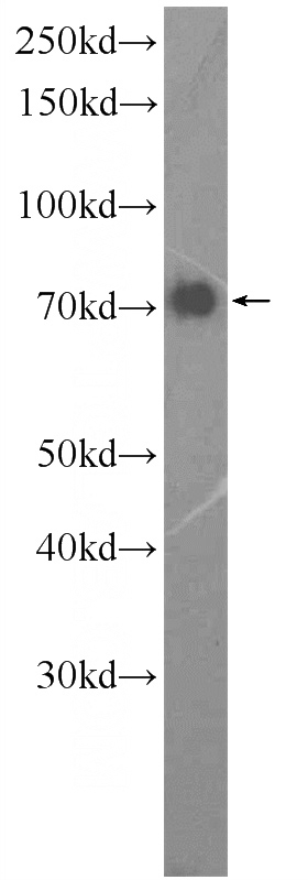 HEK-293 cells were subjected to SDS PAGE followed by western blot with Catalog No:110956(GGA1 Antibody) at dilution of 1:600