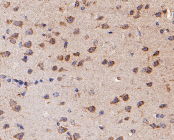 Fig4:; Immunohistochemical analysis of paraffin-embedded mouse brain tissue using anti-KCNN2 antibody. The section was pre-treated using heat mediated antigen retrieval with Tris-EDTA buffer (pH 8.0-8.4) for 20 minutes.The tissues were blocked in 5% BSA for 30 minutes at room temperature, washed with ddH; 2; O and PBS, and then probed with the primary antibody ( 1/100) for 30 minutes at room temperature. The detection was performed using an HRP conjugated compact polymer system. DAB was used as the chromogen. Tissues were counterstained with hematoxylin and mounted with DPX.