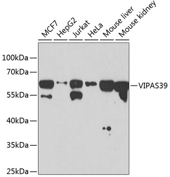 Western blot - VIPAS39 Polyclonal Antibody 