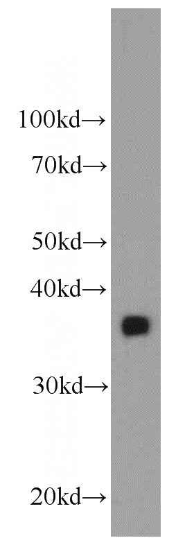 human blood tissue were subjected to SDS PAGE followed by western blot with Catalog No:107165(CLU antibody) at dilution of 1:1000