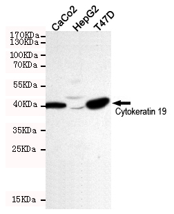 Western blot detection of Cytokeratin 19 in CaCo2,HepG2 and T-47D cell lysates using Cytokeratin 19 mouse mAb (dilution 1:500).Predicted band size:41Kda.Observed band size:41KDa.