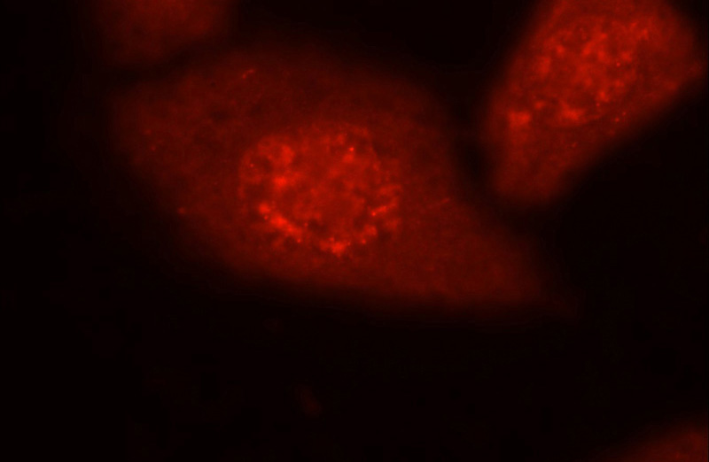 Immunofluorescent analysis of HepG2 cells using Catalog No:113000(MYPN-Specific Antibody) at dilution of 1:25 and Rhodamine-Goat anti-Rabbit IgG