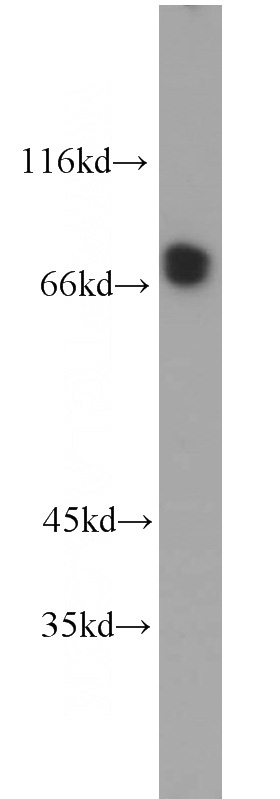 HeLa cells were subjected to SDS PAGE followed by western blot with Catalog No:109391(CLINT1 antibody) at dilution of 1:1000