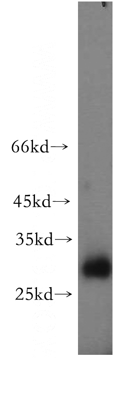 mouse colon tissue were subjected to SDS PAGE followed by western blot with Catalog No:110587(FAM3D antibody) at dilution of 1:300