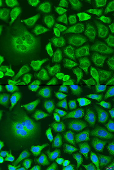 Immunofluorescence - UBIAD1 Polyclonal Antibody 