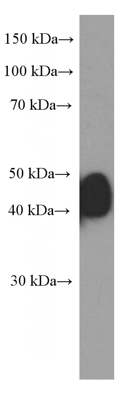 MCF-7 cells were subjected to SDS PAGE followed by western blot with Catalog No:107195(ESR2 Antibody) at dilution of 1:2000
