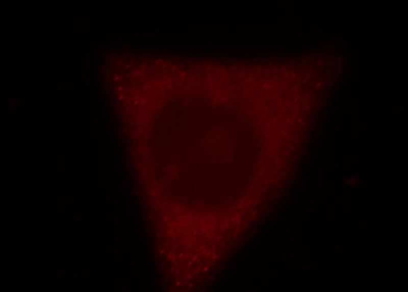 Immunofluorescent analysis of HepG2 cells, using RRM1 antibody Catalog No:114924 at 1:25 dilution and Rhodamine-labeled goat anti-rabbit IgG (red).