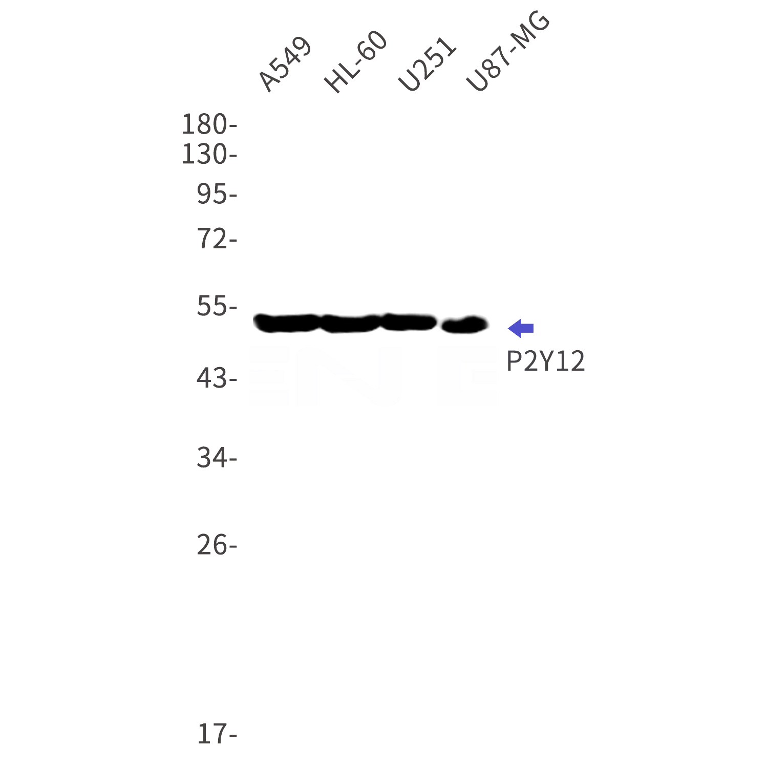 Western blot detection of P2Y12 in A549,HL-60,U251,U87-MG cell lysates using P2Y12 Rabbit mAb(1:1000 diluted).Predicted band size:40kDa.Observed band size:52kDa.