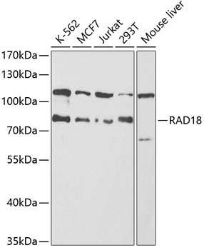 Western blot - RAD18 Polyclonal Antibody 