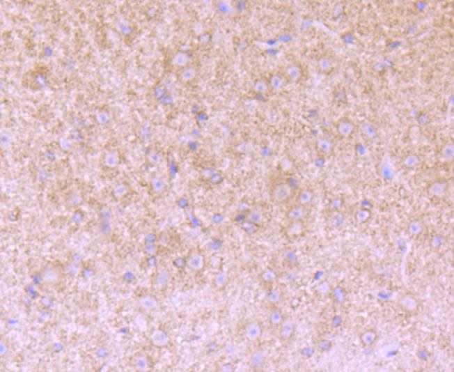 Fig3:; Immunohistochemical analysis of paraffin-embedded mouse brain tissue using anti-Versican antibody. The section was pre-treated using heat mediated antigen retrieval with Tris-EDTA buffer (pH 8.0-8.4) for 20 minutes.The tissues were blocked in 5% BSA for 30 minutes at room temperature, washed with ddH; 2; O and PBS, and then probed with the primary antibody ( 1/50) for 30 minutes at room temperature. The detection was performed using an HRP conjugated compact polymer system. DAB was used as the chromogen. Tissues were counterstained with hematoxylin and mounted with DPX.