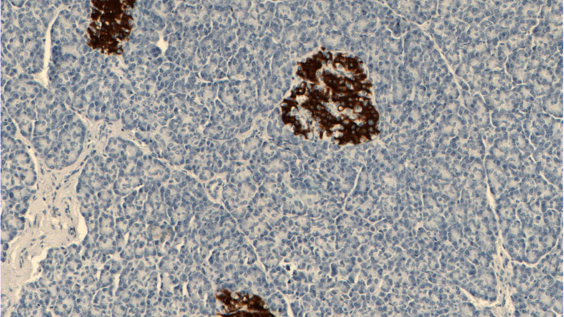 Immunohistochemistry of paraffin-embedded human pancreas tissue slide using Catalog No:107350(Insulin Antibody) at dilution of 1:5000 (under 10x lens).
