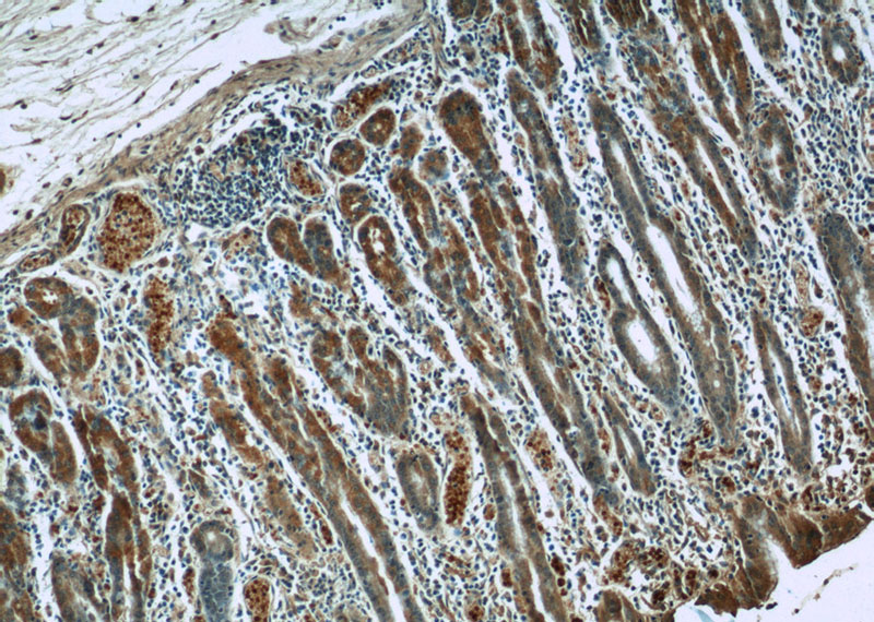 Immunohistochemistry of paraffin-embedded human stomach tissue slide using Catalog No:107234(KRT8 Antibody) at dilution of 1:50 (under 10x lens)