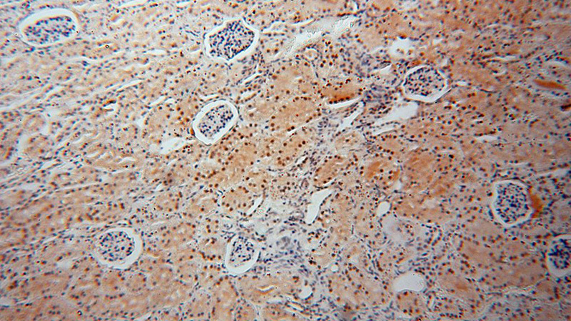 Immunohistochemical of paraffin-embedded human kidney using Catalog No:108104(ANP32A antibody) at dilution of 1:100 (under 10x lens)