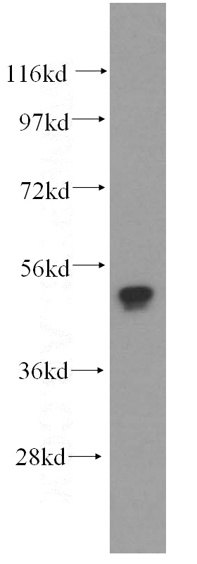 Jurkat cells were subjected to SDS PAGE followed by western blot with Catalog No:109026(FCGR2A antibody) at dilution of 1:500