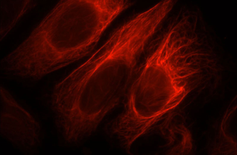 Immunofluorescent analysis of HepG2 cells, using PPP1R2P9 antibody Catalog No:114089 at 1:25 dilution and Rhodamine-labeled goat anti-rabbit IgG (red).