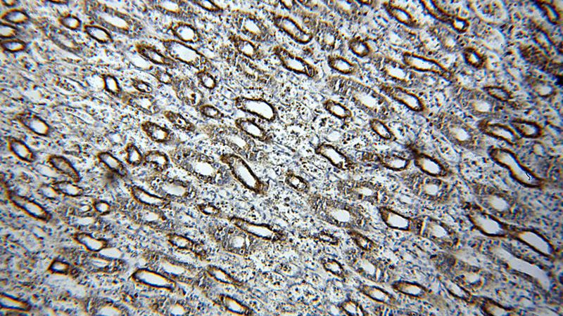 Immunohistochemical of paraffin-embedded human kidney using Catalog No:109294(CHST13-Specific antibody) at dilution of 1:100 (under 10x lens)