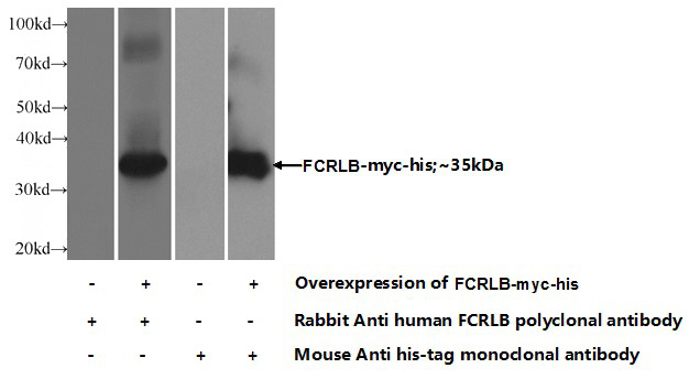 Transfected HEK-293 cells were subjected to SDS PAGE followed by western blot with Catalog No:110605(FCRLB Antibody) at dilution of 1:1000