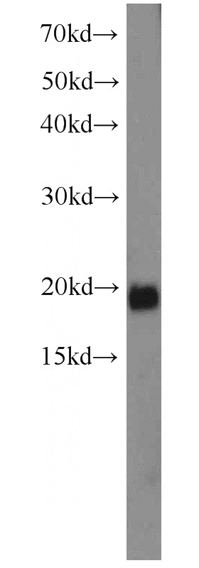 HeLa cells were subjected to SDS PAGE followed by western blot with Catalog No:114610(RBM3 antibody) at dilution of 1:500
