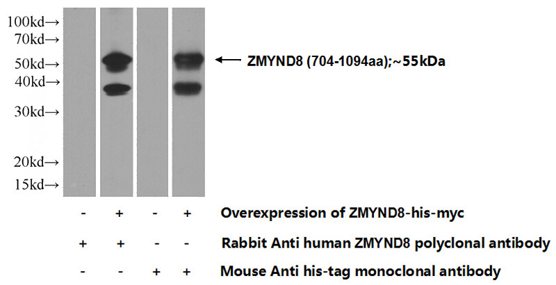 Transfected HEK-293 cells were subjected to SDS PAGE followed by western blot with Catalog No:116943(ZMYND8 Antibody) at dilution of 1:1000