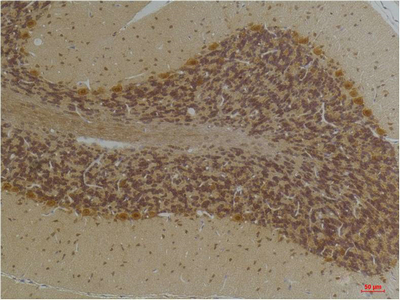 Fig2:; Immunohistochemical analysis of paraffin-embedded Human BrainTissue using KCNN2(SK2) Rabbit pAb diluted at 1:200.