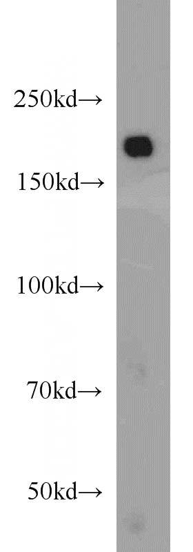 HeLa cells were subjected to SDS PAGE followed by western blot with Catalog No:111824(IQGAP1 antibody) at dilution of 1:1000