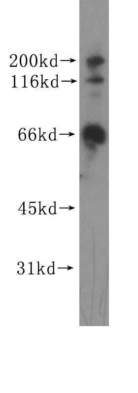 HEK-293 cells were subjected to SDS PAGE followed by western blot with Catalog No:111215(GRK6 antibody) at dilution of 1:500