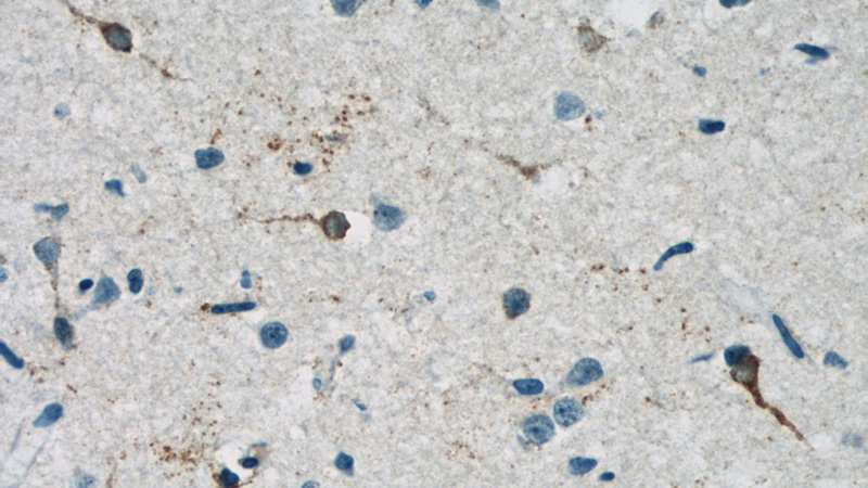 Immunohistochemistry of paraffin-embedded human brain tissue slide using Catalog No:114919(RRAGB Antibody) at dilution of 1:50 (under 40x lens)