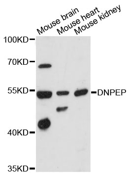 Western blot - DNPEP Polyclonal Antibody 