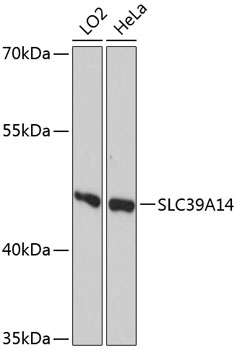 Western blot - SLC39A14 Polyclonal Antibody 
