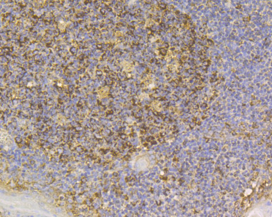 Fig5:; Immunohistochemical analysis of paraffin-embedded human tonsil tissue using anti-SLC8B1 antibody. The section was pre-treated using heat mediated antigen retrieval with Tris-EDTA buffer (pH 8.0-8.4) for 20 minutes.The tissues were blocked in 5% BSA for 30 minutes at room temperature, washed with ddH; 2; O and PBS, and then probed with the primary antibody ( 1/100) for 30 minutes at room temperature. The detection was performed using an HRP conjugated compact polymer system. DAB was used as the chromogen. Tissues were counterstained with hematoxylin and mounted with DPX.
