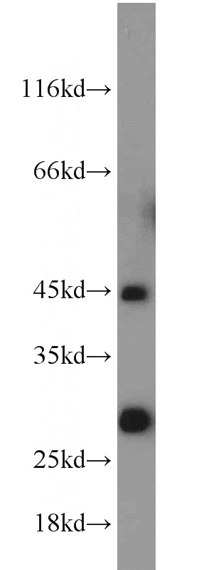 mouse testis tissue were subjected to SDS PAGE followed by western blot with Catalog No:111525(HORMAD1 antibody) at dilution of 1:1000