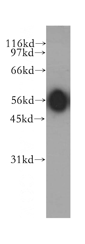 mouse testis tissue were subjected to SDS PAGE followed by western blot with Catalog No:107754(ACVR1C antibody) at dilution of 1:300