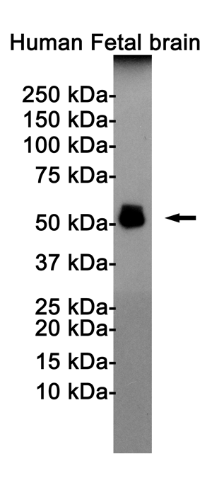Western blot detection of Anti-Tau (phospho T181) antibody in Human Fetal brain cell lysates using Anti-Tau (phospho T181) antibody(1:1000 diluted).Predicted band size:79KDa.Observed band size:50-80KDa.