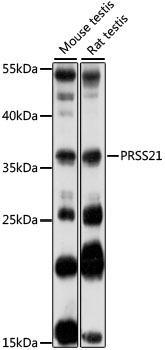 Western blot - PRSS21 Polyclonal Antibody 