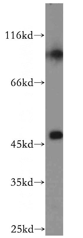 human placenta tissue were subjected to SDS PAGE followed by western blot with Catalog No:115330(SLC25A24 antibody) at dilution of 1:1500