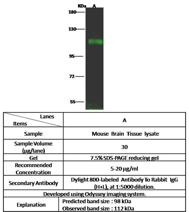 Human DPP6 Western blot (WB) 14569