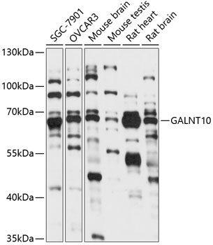 Western blot - GALNT10 Polyclonal Antibody 