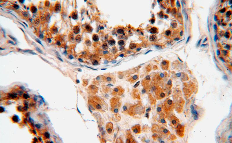 Immunohistochemical of paraffin-embedded human testis using Catalog No:110684(FKBPL antibody) at dilution of 1:50 (under 40x lens)